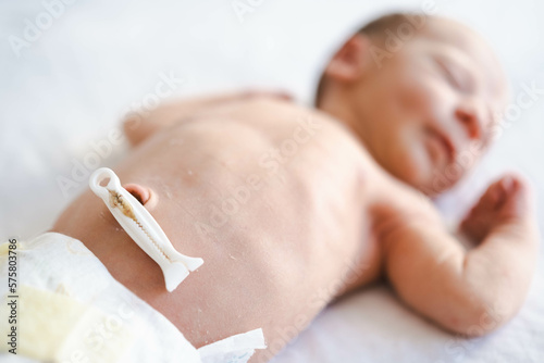Defocused caucasian hairy brunet cute newborn baby few days old,sleeping,lying on bed on back,umbilical cord remnant.Close up of belly button.Few days old child wearing diaper.