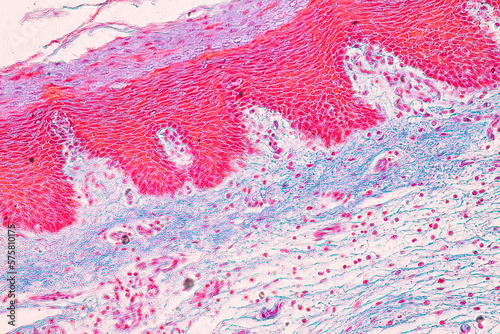 Adipose tissue human  Soft palate human  Bone human and Striated  skeletal  muscle human under the microscope in Lab.
