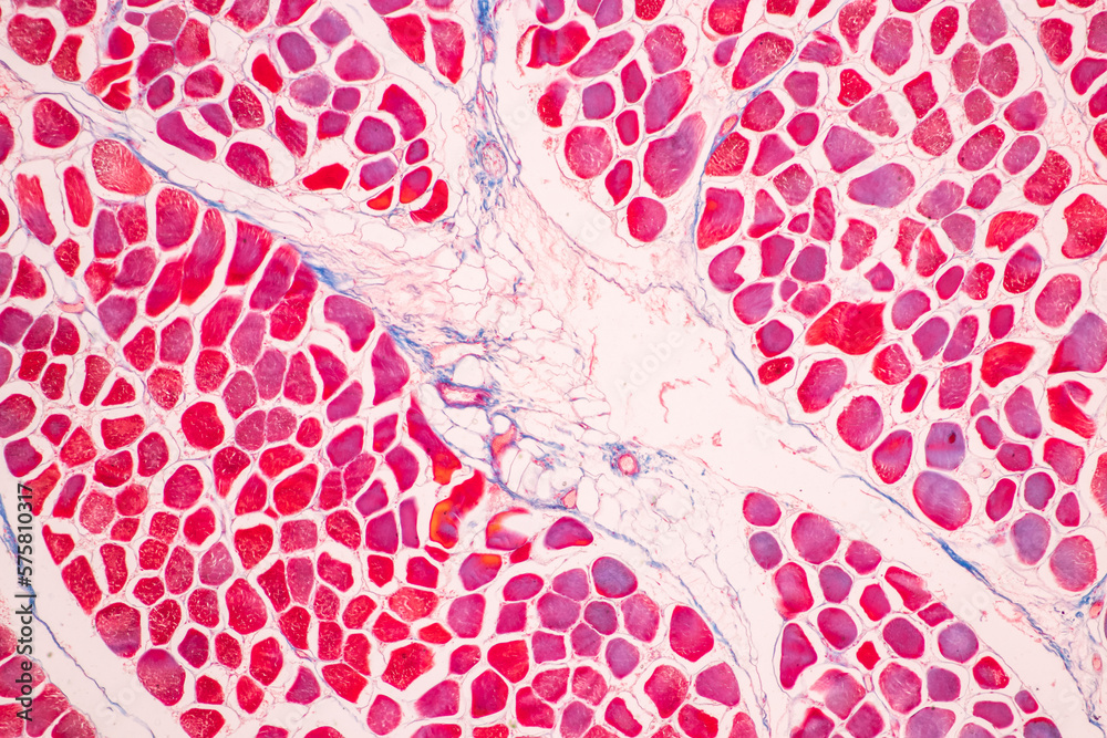 Adipose tissue human, Soft palate human, Bone human and Striated (skeletal) muscle human under the microscope in Lab. - obrazy, fototapety, plakaty 