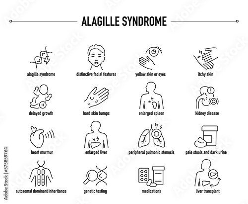 Alagille Syndrome symptoms, diagnostic and treatment vector icon set. Line editable medical icons.
