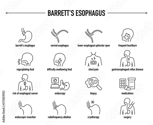 Barrett's Esophagus symptoms, diagnostic and treatment vector icon set. Line editable medical icons.