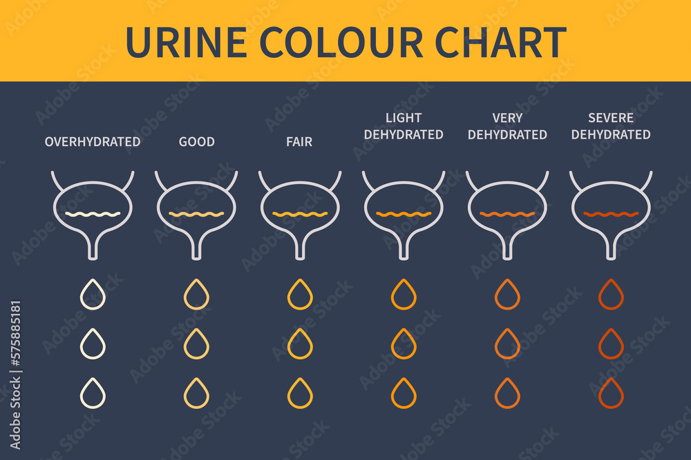 Urine color chart diagram. Bladders with urine drops showing different