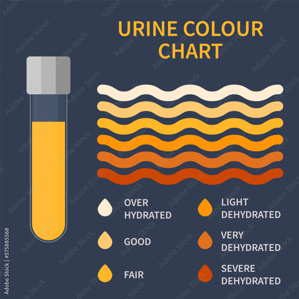 Urine colour chart. Hydration and dehydration level diagram. Medical ...