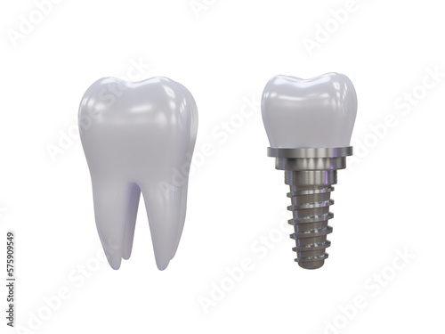 Dental implant isolated on transparent background. 3d render. Tooth. Render. Dentistry, medicine concept. 3D rendering, for web, ui, ux, png. Teeth. Health. Tooth human implants 