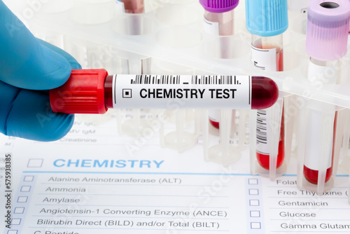 Doctor in Laboratory with collection of blood testing sample tube for Chemist analysis. Technician holding tube with blood sample from patient in the Chemistry test lab photo