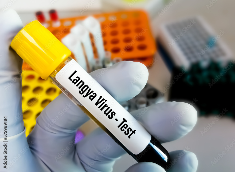 Medical laboratory scientist holding blood sample for Langya virus test.