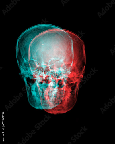X-ray film of the skull double color.