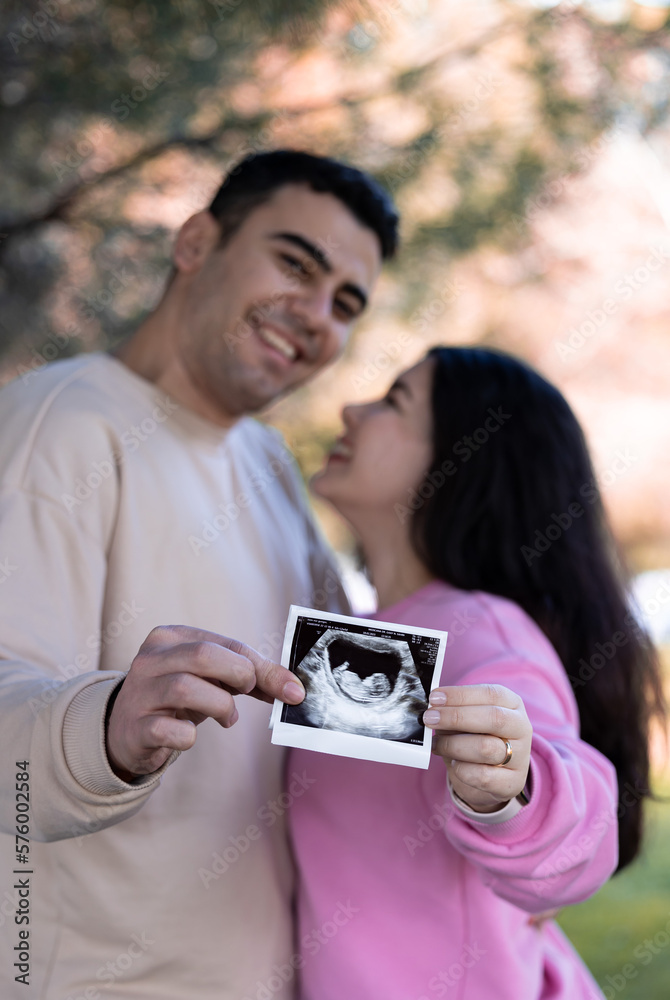 Pregnancy announcement concept. Wife and husband holding ultrasound picture of their future baby. Pregnancy announcement concept. Wife and husband holding ultrasound picture of their future baby.