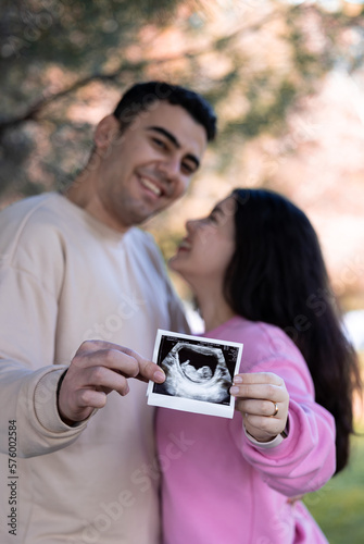 Pregnancy announcement concept. Wife and husband holding ultrasound picture of their future baby.