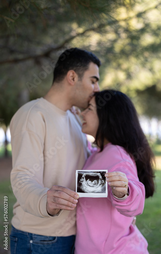 Pregnancy announcement concept. Wife and husband holding ultrasound picture of their future baby.