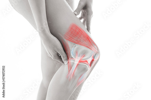 Knee pain, meniscus inflamed, human leg medically accurate representation of an arthritic knee joint. Persistent, sharp discomfort in the knee joint, accompanied by swelling and stiffness