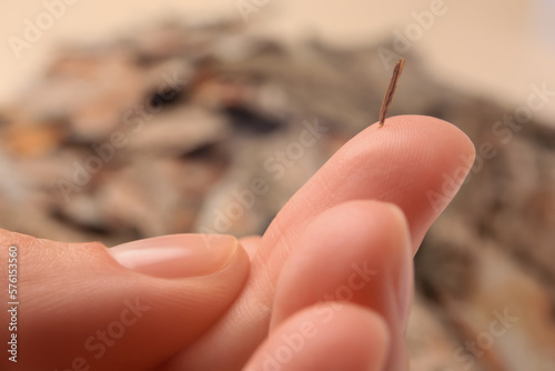 Woman with splinter in her finger on blurred background, closeup photo