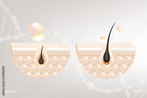 Hyaluronic acid before and after hair and skin solutions ad. white collagen serum drop into skin cells with cosmetic advertising background ready to use, illustration vector.
