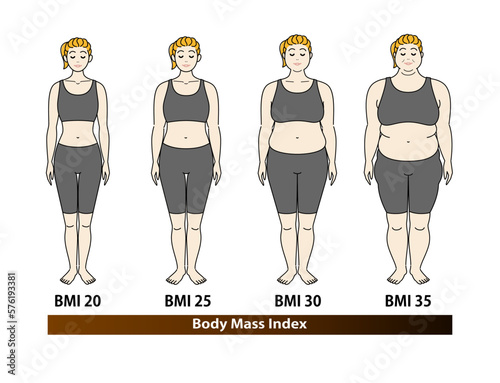 ボディマスインデックス 若い女性の体形変化 ダイエットのビフォーアフター 正面 イラスト ベクター	