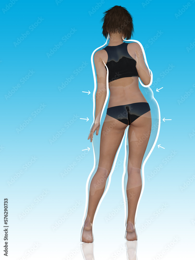 Conceptual fat overweight obese female vs slim fit healthy body after weight loss or diet with white outline and pointing arrows on blue. A fitness, nutrition or obesity, health shape 3D illustration Conceptual fat overweight obese female vs slim fit healthy body after weight loss or diet with white outline and pointing arrows on blue. A fitness, nutrition or obesity, health shape 3D illustration