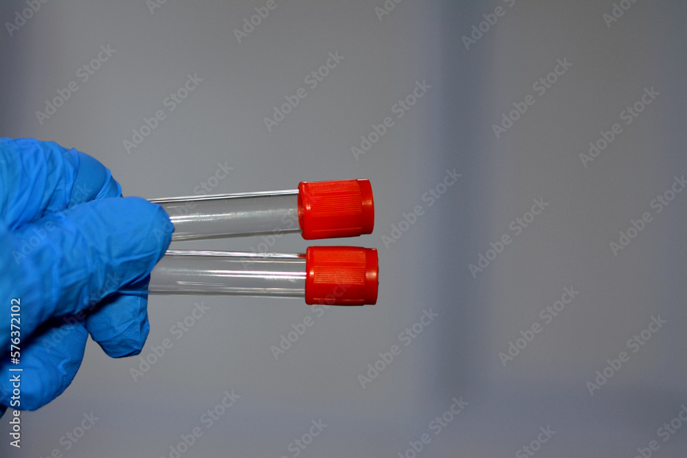 Blood collection tube for collecting blood samples for laboratory