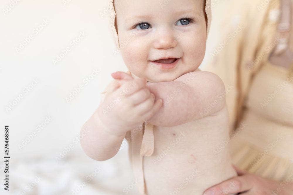 close up of baby hands with disability limb difference close up of baby hands with disability limb difference