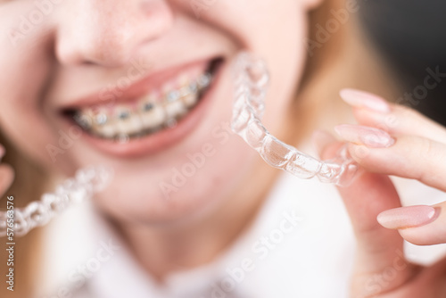 girl with a beautiful smile holding a transparent mouth guard photo