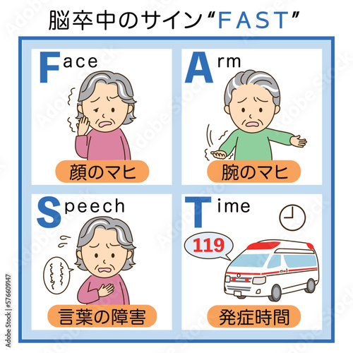 脳卒中チェックFASTの説明イラスト１