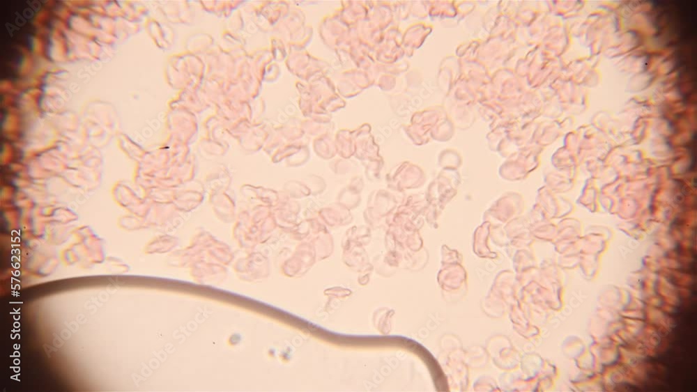 Part of the lens is blurred on the sides. Blood cells are moving in ...