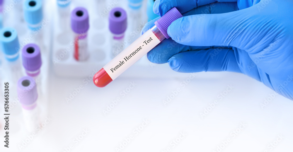 Naklejka premium Doctor holding a test blood sample tube with female hormone test on the background of medical test tubes with analyzes.Copy space for text