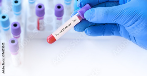 Doctor holding a test blood sample tube with female hormone test on the background of medical test tubes with analyzes.Copy space for text