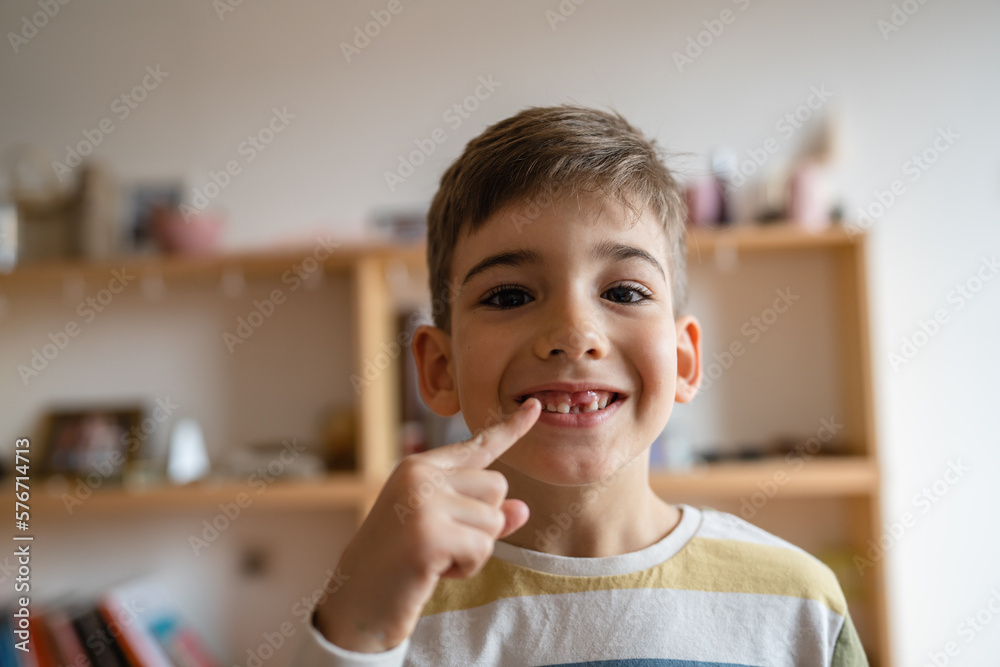 boy with Deciduous primary milk teeth lost tooth fallen out dropped boy with Deciduous primary milk teeth lost tooth fallen out dropped