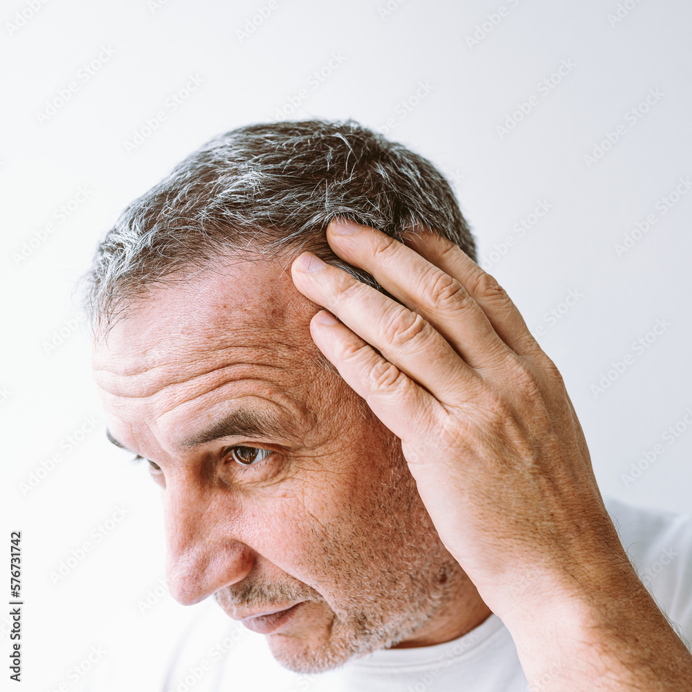 Obraz premium Middle-aged man demonstrates gray hair, hair loss problem, close-up