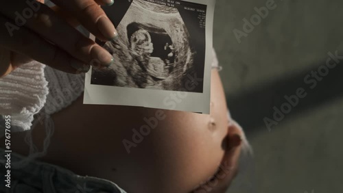 Wallpaper Mural The belly of a pregnant girl in a white bodysuit close-up. Ultrasound scan in a hand. Beautiful natural light	
 Torontodigital.ca