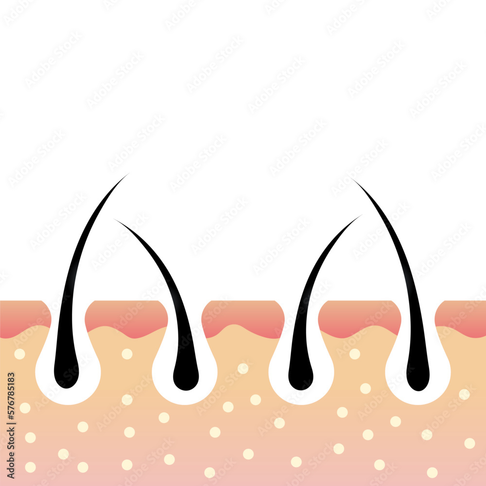 Skin anatomy. Hair follicle. Skin layers. Dermatology concept. Hair