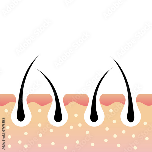 Skin anatomy. Hair follicle. Skin layers. Dermatology concept. Hair roots inside the skin. Vector