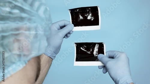 Doctor in a medical gown and cap with sterile gloves, ultrasound of the prostate gland of a man. Diagnosis, The doctor analyzes the ultrasound of human prostate adenoma. Potency. Healthy concept. photo