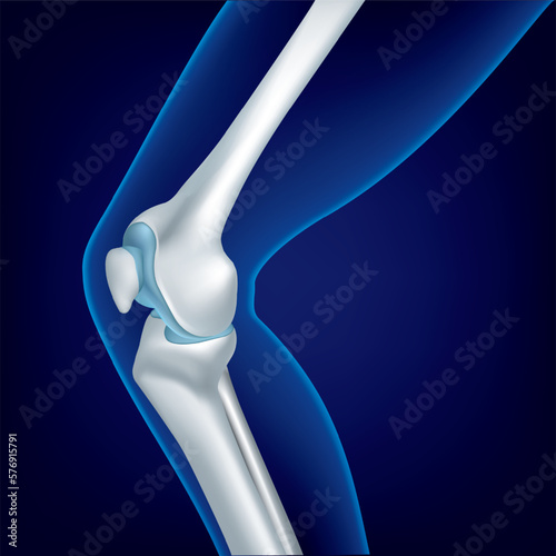 Educational medical illustration of leg bones and knee.