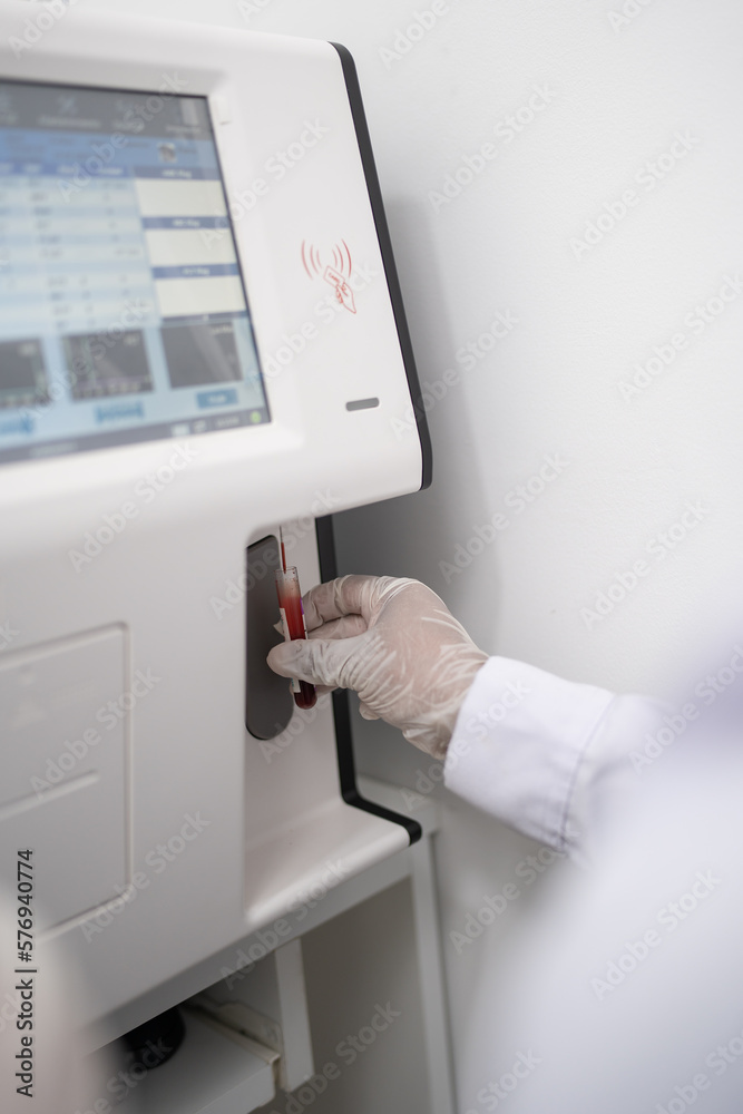 A scientist's hand analyzing a blood test A scientist's hand analyzing a blood test
