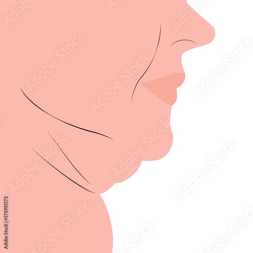 Fat double chin vector illustration