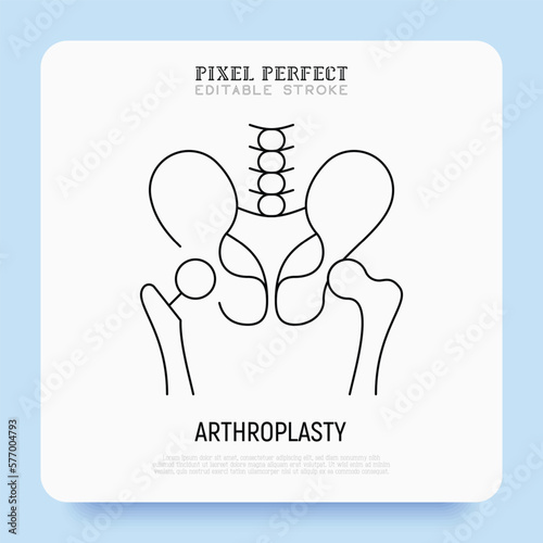 Arthroplasty thin line icon, artificial joint, surgical procedure to restore joint. Arthritis. Pixel perfect, editable stroke. Vector illustration.