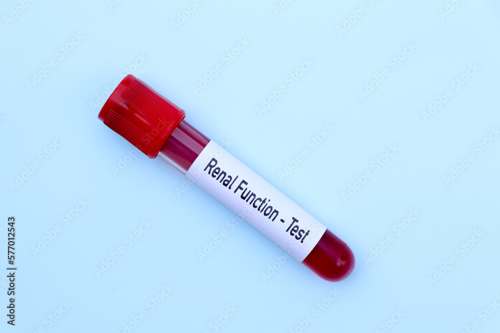 renal function test to look for abnormalities from blood renal function test to look for abnormalities from blood