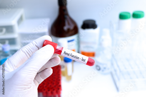 renal function test to look for abnormalities from blood