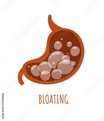 Bloating stomach concept. Gas bubbles in intestines. Medical infographic, anatomy and biology. Ill internal organ with synrome, flatulence. Cartoon flat vector illustration