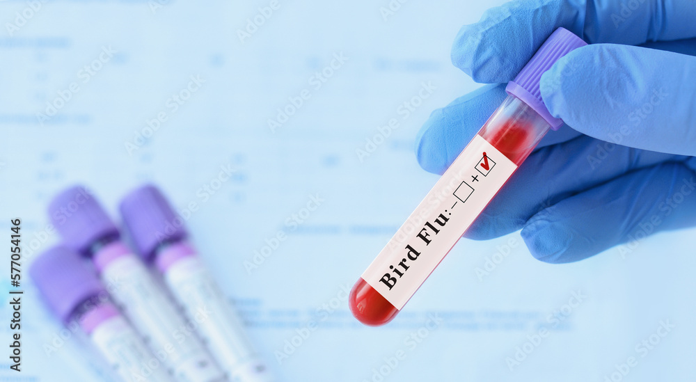 Naklejka premium Doctor holding a test blood sample tube positive with Bird Flu test on the background of medical test tubes with analyzes.