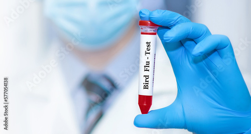 Doctor holding a test blood sample tube with Bird Flu test.