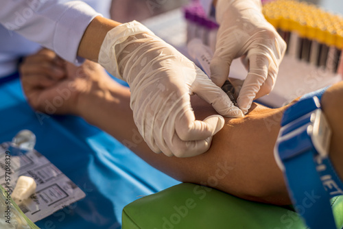 Close-up view, a nurse wearing white latex gloves is using a syringe to puncture a major artery.