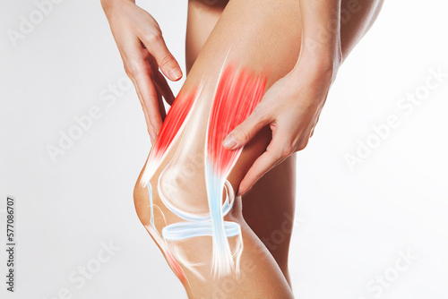 Knee pain, meniscus inflamed, human leg medically accurate representation of an arthritic knee joint. Persistent, sharp discomfort in the knee joint, accompanied by swelling and stiffness photo