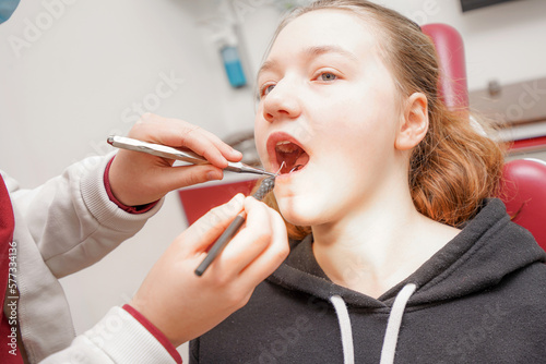A dentist examines the teeth in the mouth of a girl.