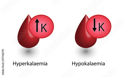 Hyperkalaemia, high plasma potassium level and Hypokalaemia, low plasma potassium level. Potassium K excess and deficit electrolyte disorders, blood test tube, Scientific design. Vector illustration.
