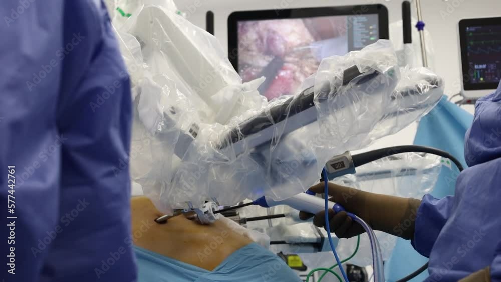 4K Real robotic prostate surgery. Closeup robotic moves on human