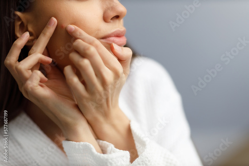 Squeezes upset young woman in white bathrobe examines pimples on her face close up. Problematic skin on the face, acne. Portrait of girl removing pimples in the bathroom. Beauty and health of the skin