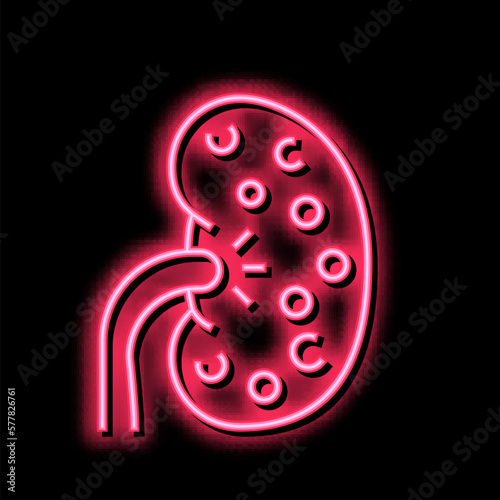 nephritis kidney neon glow icon illustration