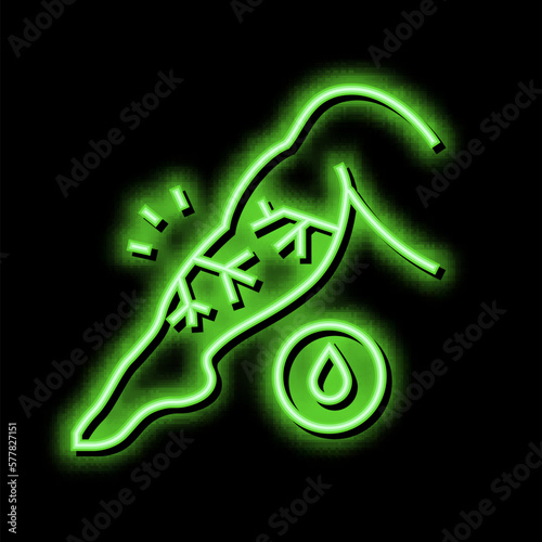 venous edema neon glow icon illustration
