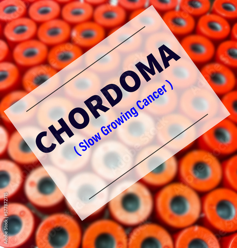 Chordoma word at test tube caps background, medical term word with medical concepts in blackboard and medical equipment. notochordal sarcoma. photo